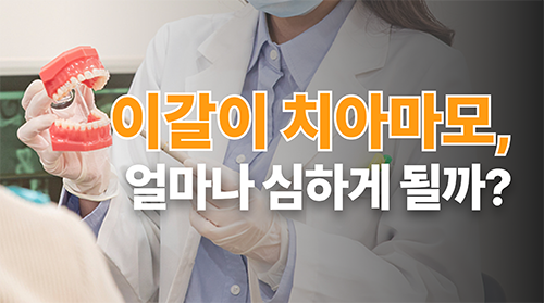 이갈이 심하면 치아 마모 얼마나 되나요?